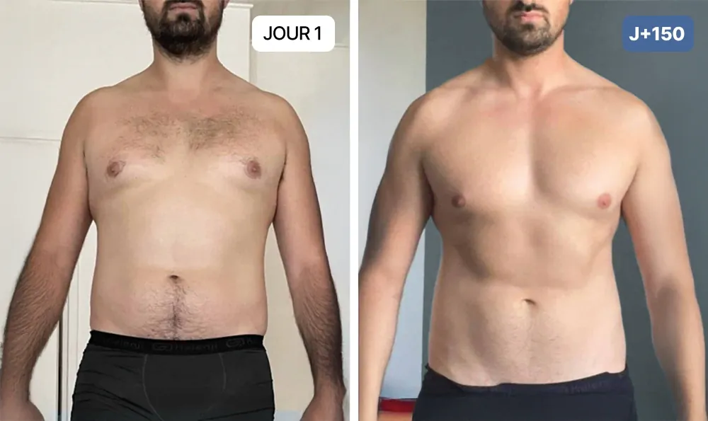 Nuclever Cortisol Manager prima e dopo uomo: pancia più piatta dopo 150 giorni