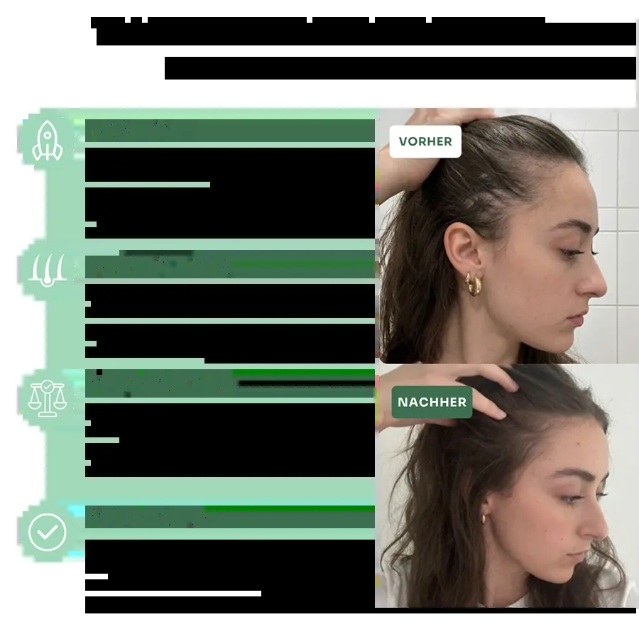 Nuclever DHT Blocker: quando si vedono i primi risultati, dal mese 1 al mese 6